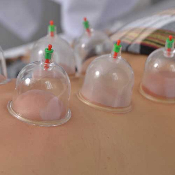 Cupping Therapy Set 6 Pieces
