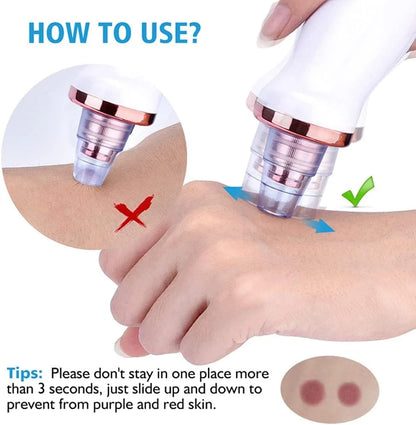 جهاز تنظيف الرؤوس السوداء القابل لإعادة الشحن بخمسة رؤوس (5347)