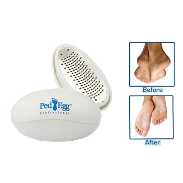 Ped Egg Foot File